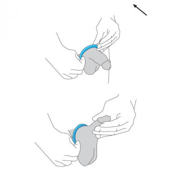 Boîte de 3 anneaux d'érection AP Erectionrings