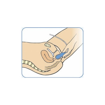 EPI-NO DELPHINE PLUS