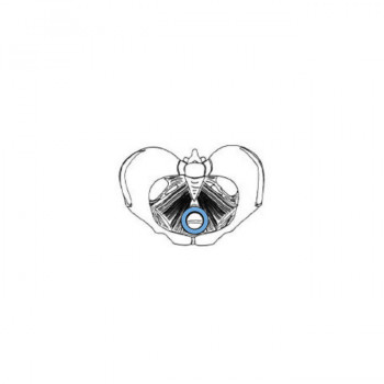 ring pessary